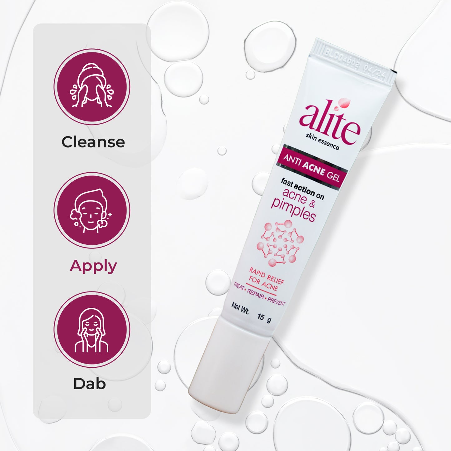 Alite Anti Acne Gel 30 gm