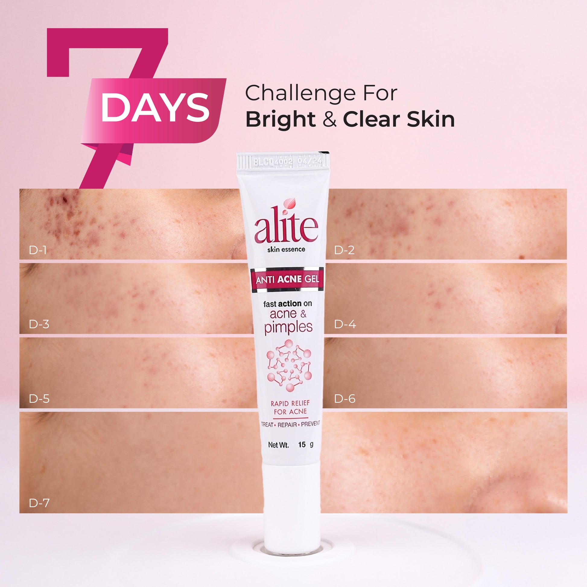 Anti Acne Gel